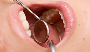 お口の中の痛みや出来物を治療